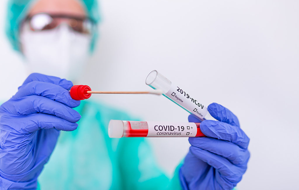 ПЦР-тест на коронавирус